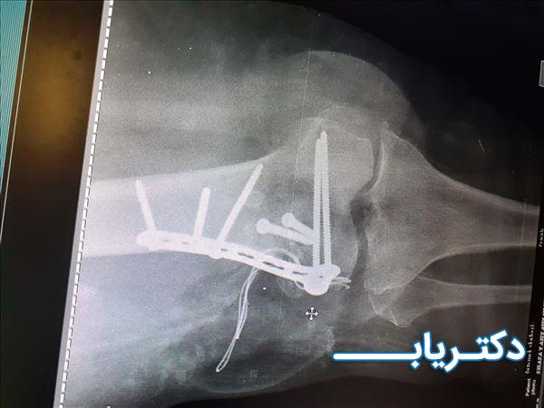نمونه کار دکتر حسین کریمی هریس 2
