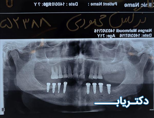 نمونه کار دکتر شهریار جنانی