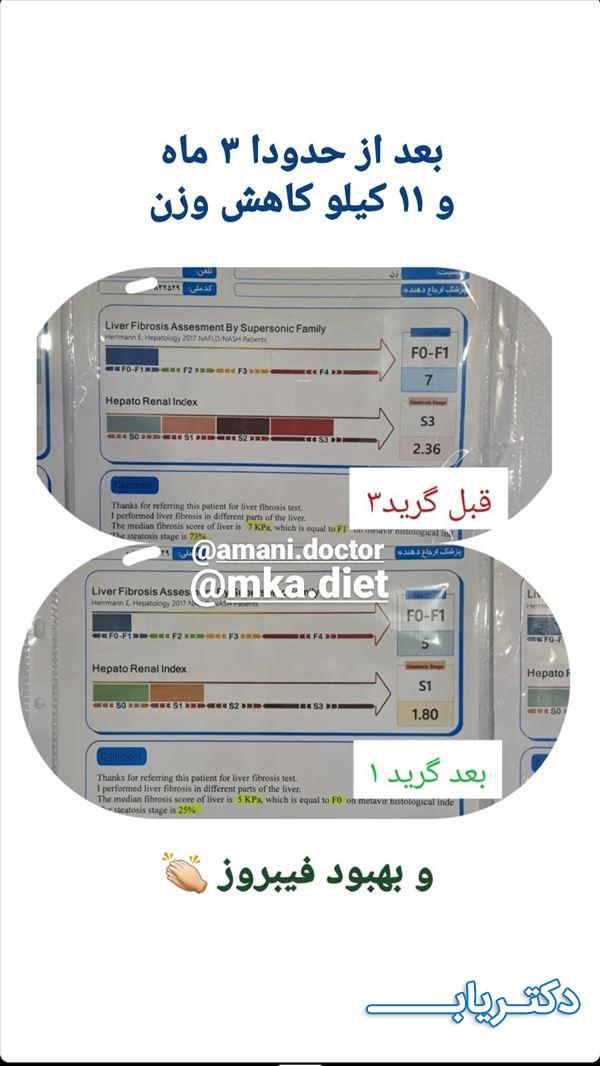 نمونه کار مریم کاشی