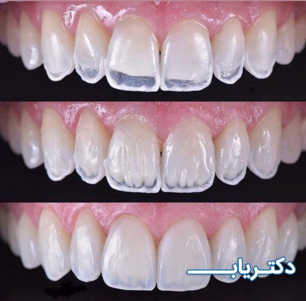 نمونه کار دکتر آرش لعلی نیا 1