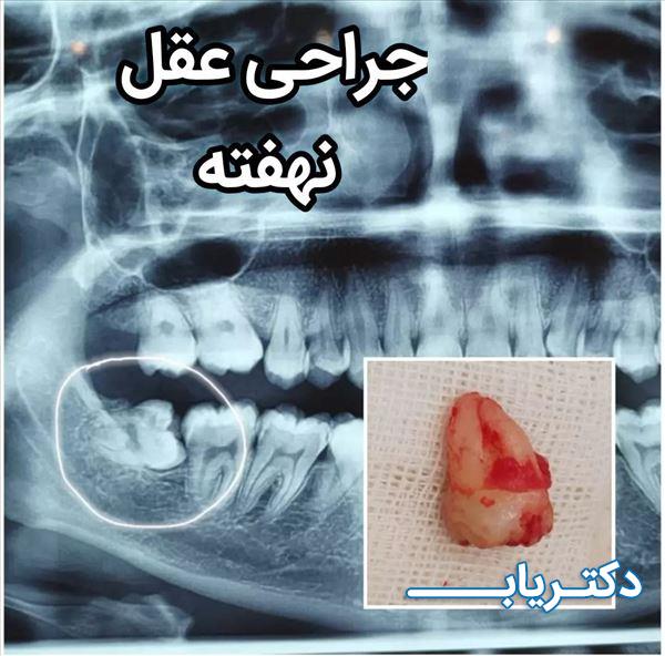نمونه کار دکتر آرش لعلی نیا 4