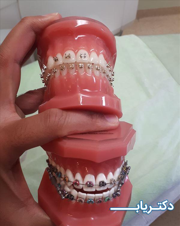 نمونه کار دکتر آرش لعلی نیا 5
