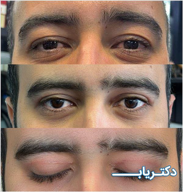 نمونه کار دکتر سمیه حسین‌زاده