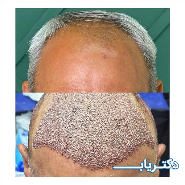 نمونه کار دکتر سمیه حسین‌زاده