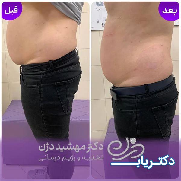 نمونه کار دکتر مهشید دژن 3