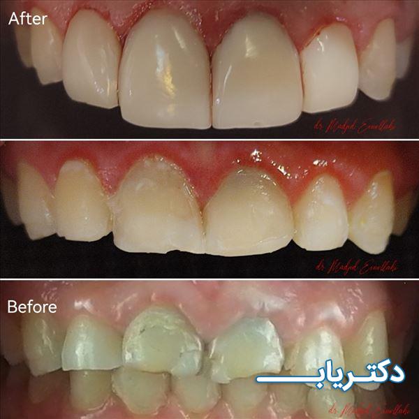 نمونه کار دکتر مجید عین الهی 5