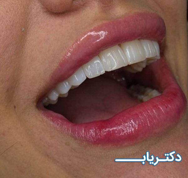 نمونه کار دکتر المیرا فردی