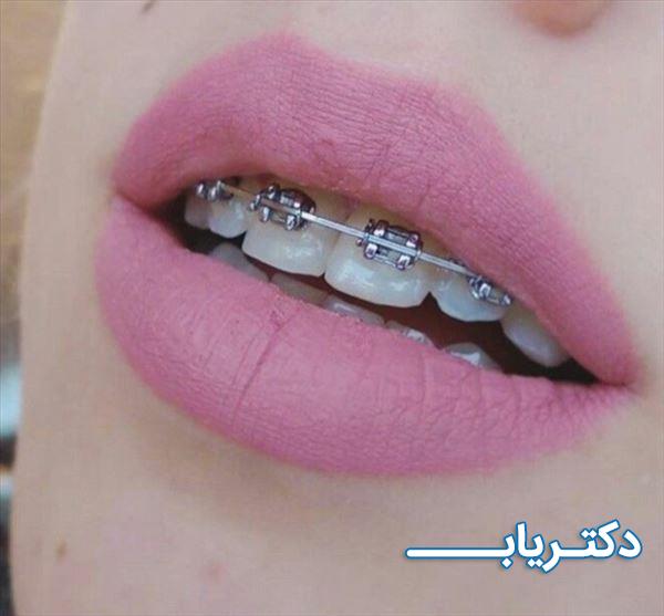 نمونه کار دکتر المیرا فردی