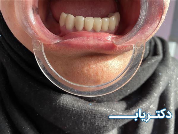نمونه کار دکتر مهدی ذاکری خطیر 5