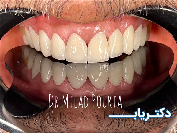 نمونه کار دکتر میلاد پوریا 5