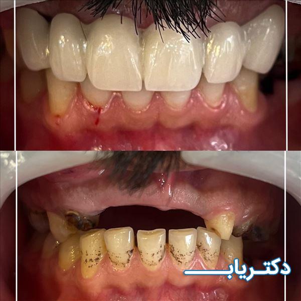 نمونه کار دکتر مصطفی یگانگی