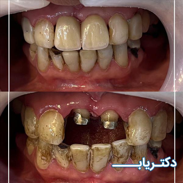 نمونه کار دکتر مصطفی یگانگی