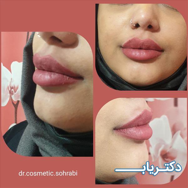 نمونه کار دکتر مژگان کریمی 5