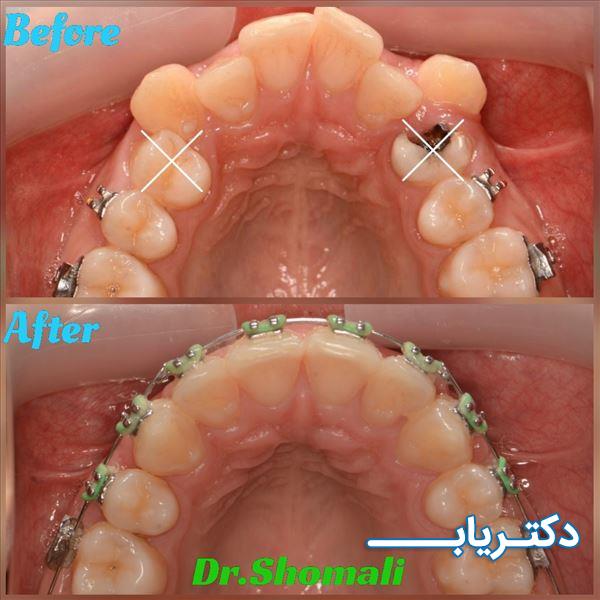 نمونه کار دکتر مهرداد شمالی