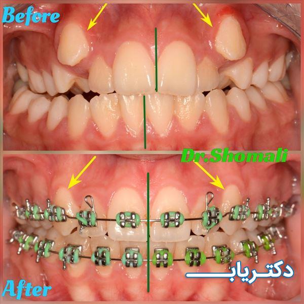 نمونه کار دکتر مهرداد شمالی