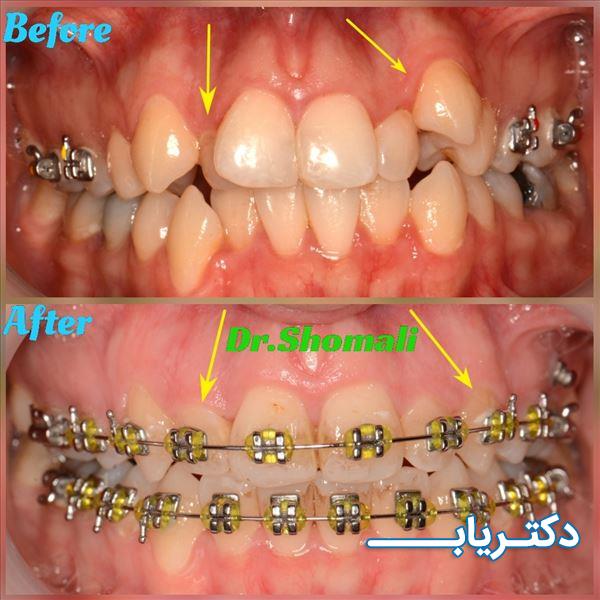 نمونه کار دکتر مهرداد شمالی