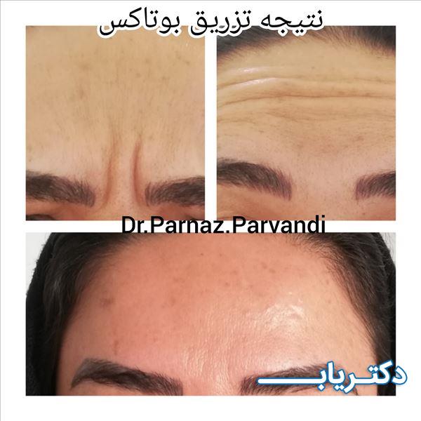 نمونه کار دکتر پرناز پروندی