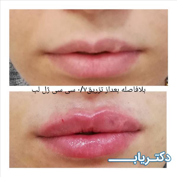 نمونه کار دکتر پرناز پروندی