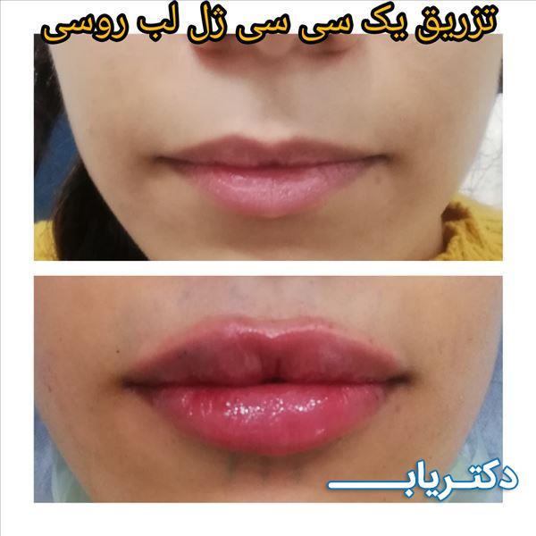 نمونه کار دکتر پرناز پروندی