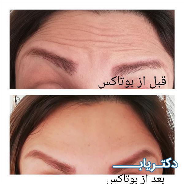 نمونه کار دکتر پرناز پروندی