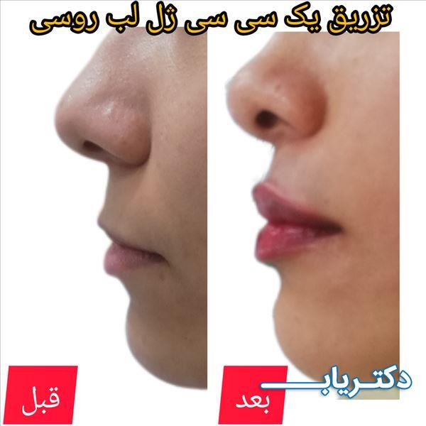 نمونه کار دکتر پرناز پروندی