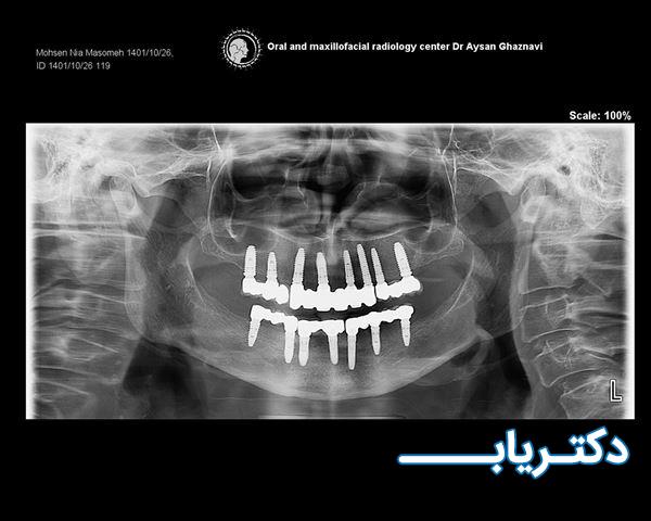 نمونه کار دکتر پویا علیائی 4