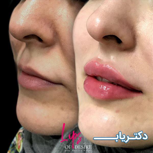 نمونه کار دکتر روزیتا عظیمی