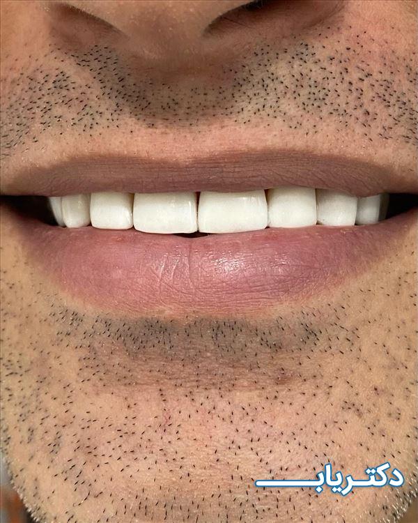 نمونه کار دکتر سعید مزیدی 3