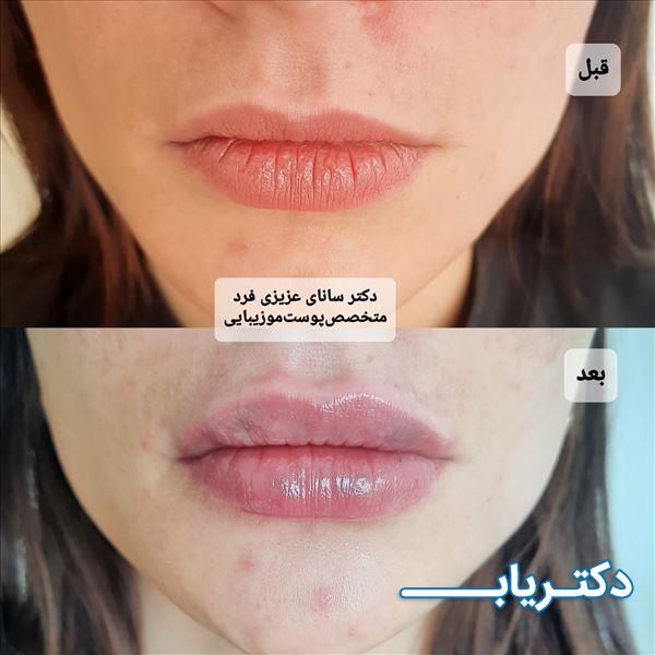 نمونه کار دکتر سانای عزیزی فرد 2