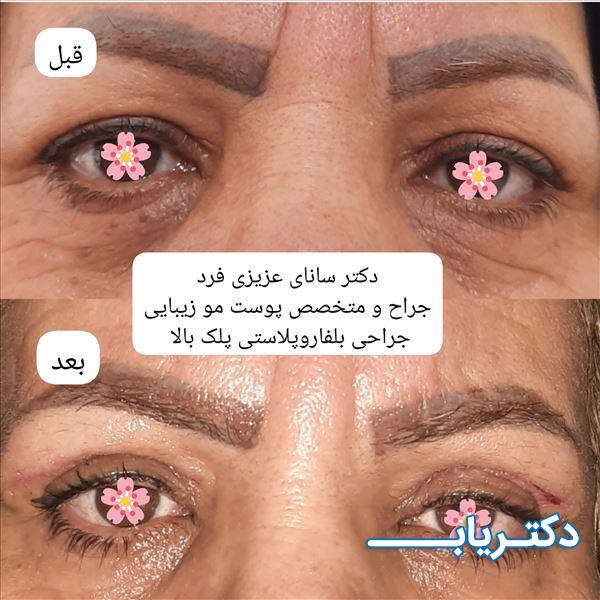 نمونه کار دکتر سانای عزیزی فرد 4