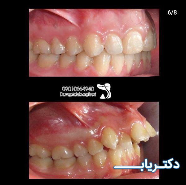 نمونه کار دکتر سپیده باقری