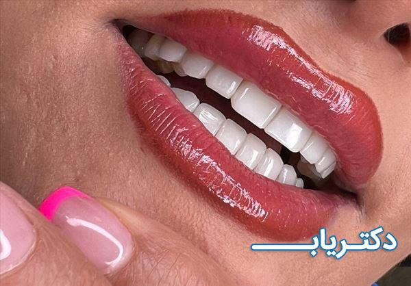 نمونه کار دکتر سیده سمانه موسوی 4