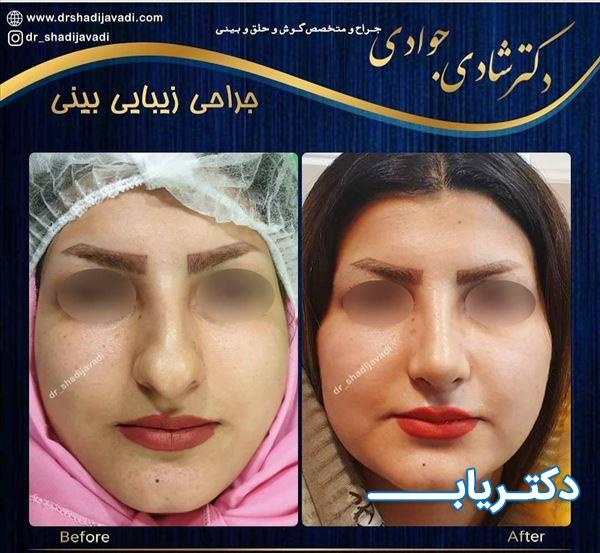 نمونه کار دکتر شادی جوادی 3