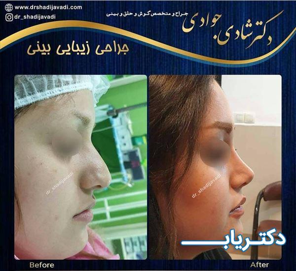نمونه کار دکتر شادی جوادی 4