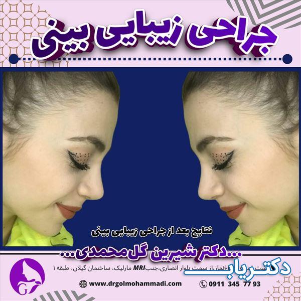 نمونه کار دکتر شیرین گل محمدی 2