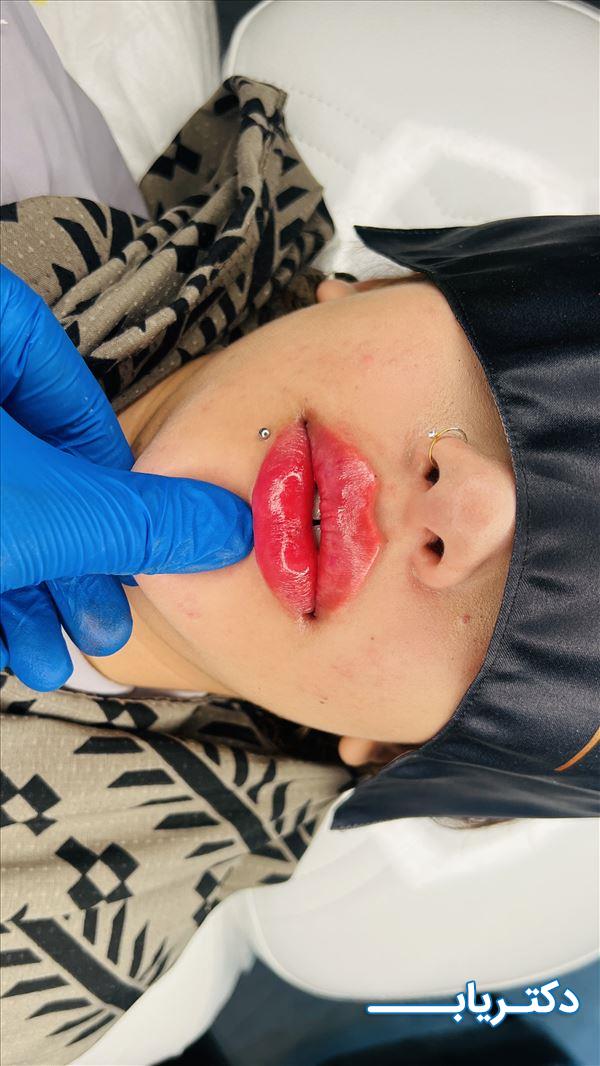 نمونه کار دکتر سجاد زرین 4
