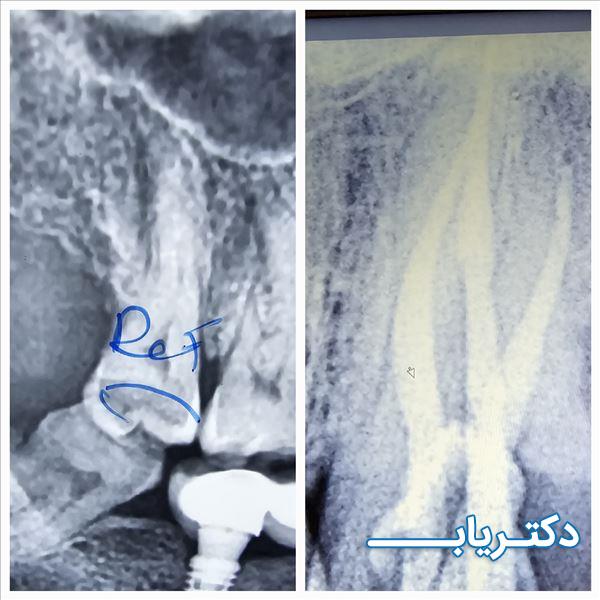 نمونه کار دکتر سروش برهانی