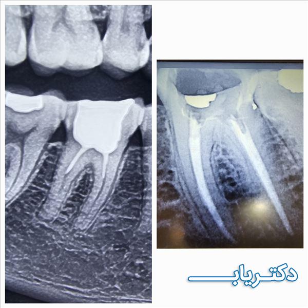 نمونه کار دکتر سروش برهانی