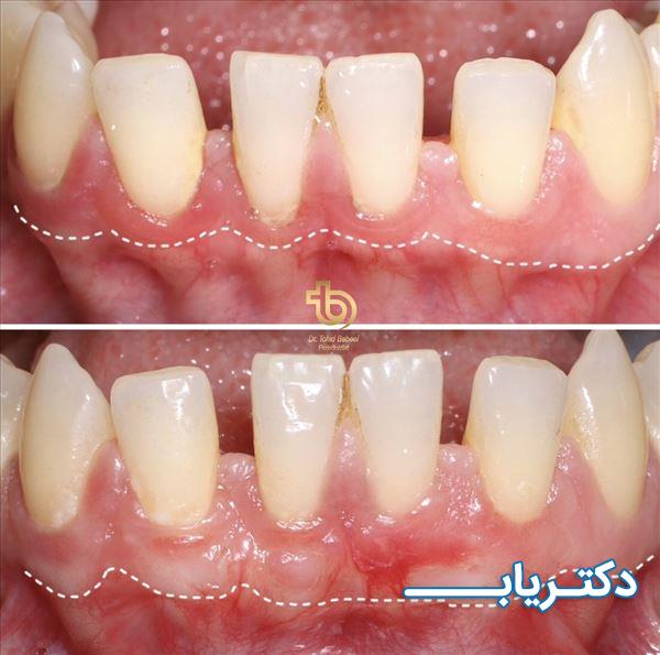 نمونه کار دکتر توحید بابایی