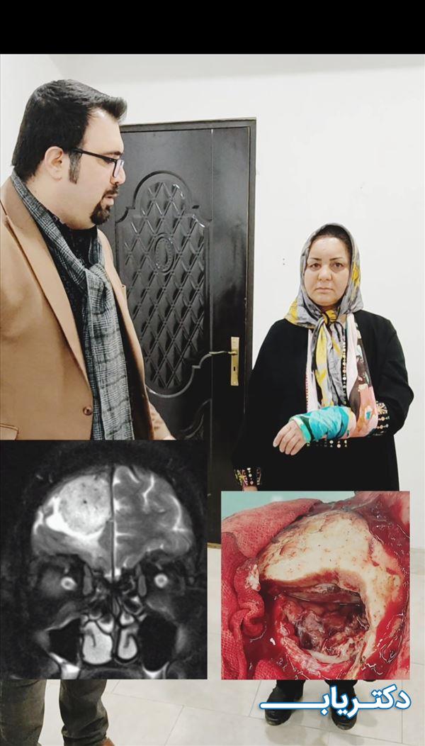 نمونه کار دکتر وحید آقایی