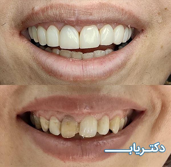 نمونه کار دکتر یاسمن قاسمی 2