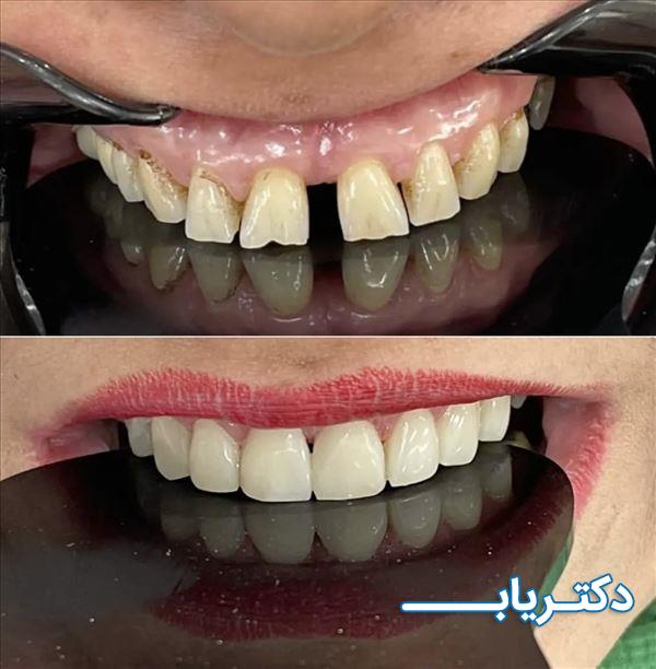 نمونه کار دکتر یاسمن قاسمی 4