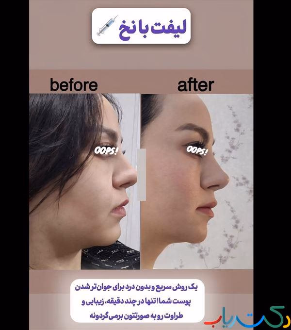 image خدادادي