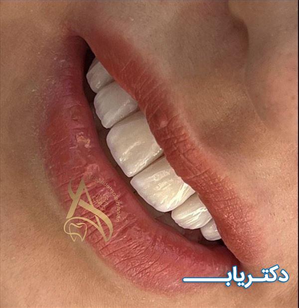 نمونه کار دکتر آزاده سلیمانیان 3