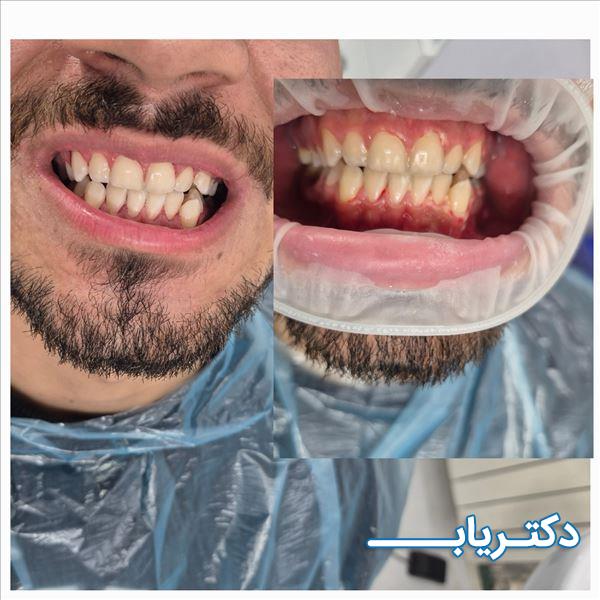 نمونه کار دکتر مجتبی ایمانپور