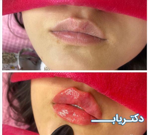 نمونه کار دکتر مطهره میر 2
