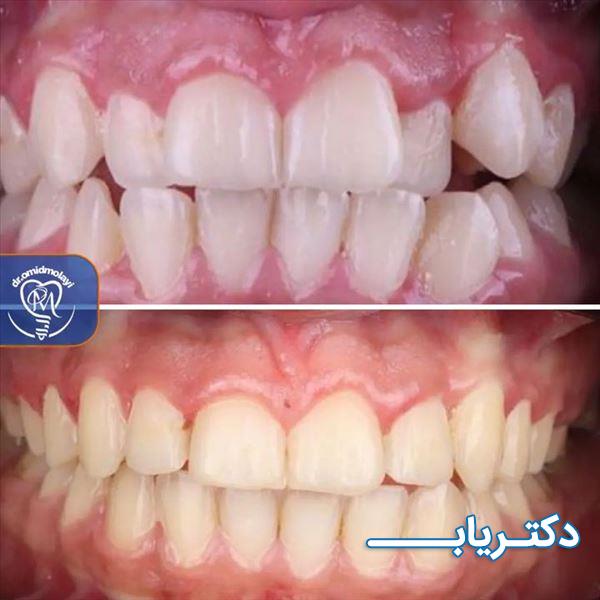 نمونه کار دکتر امید مولایی 1