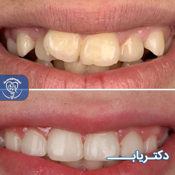 نمونه کار دکتر امید مولایی 2