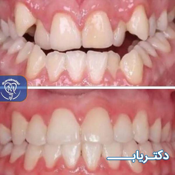 نمونه کار دکتر امید مولایی 3