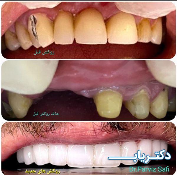 نمونه کار دکتر پرویز صافی 2